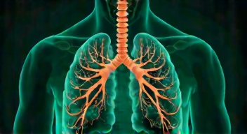 Die Realität der Bronchiektasen